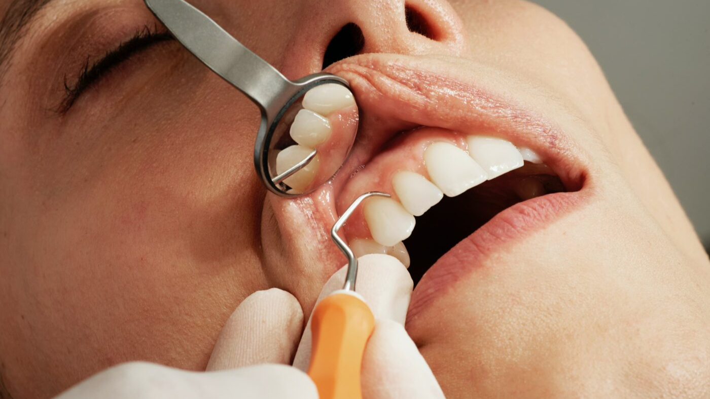 Do Students Get Free Dental Care? NHS vs Private Dentist Prices